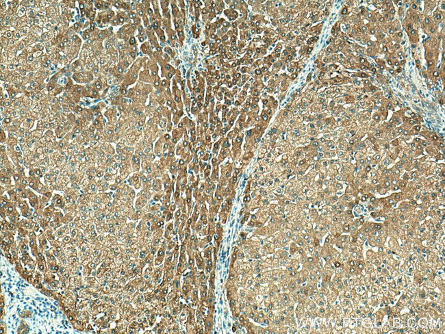 ALDH1A3 Antibody in Immunohistochemistry (Paraffin) (IHC (P))