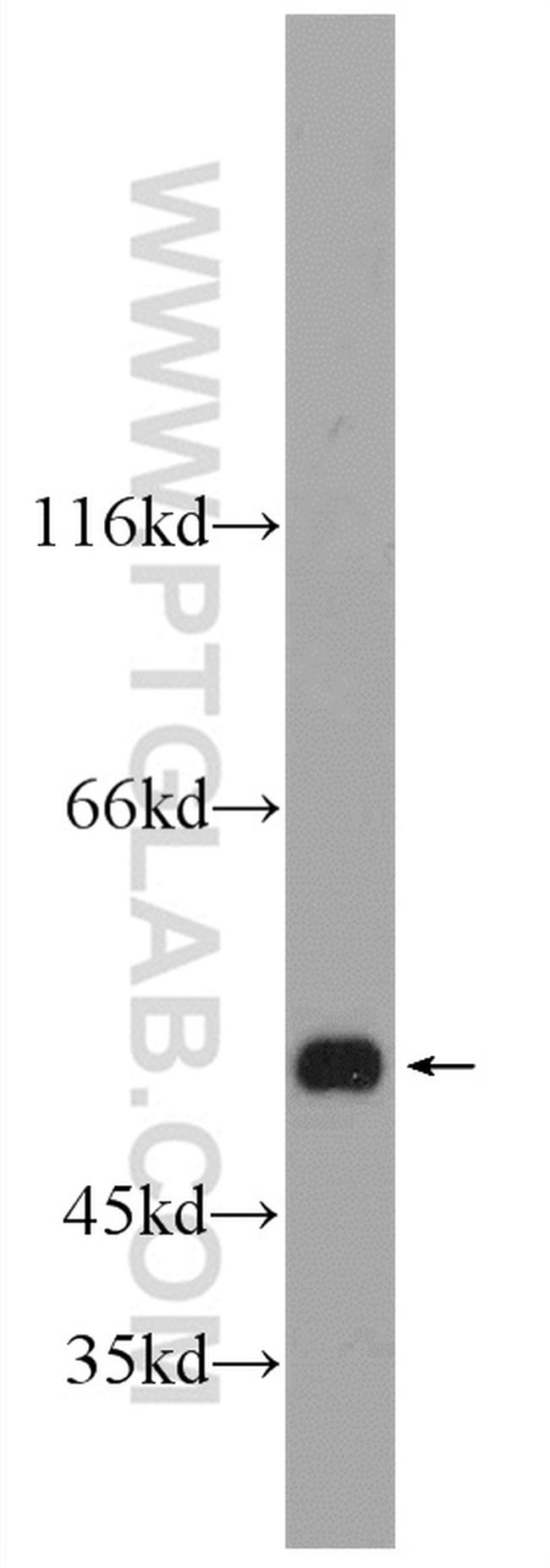 ALDH1A3 Antibody in Western Blot (WB)