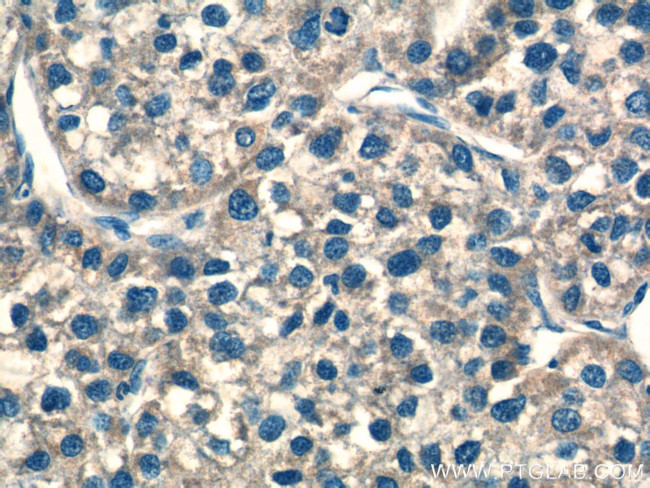 NDUFS8 Antibody in Immunohistochemistry (Paraffin) (IHC (P))