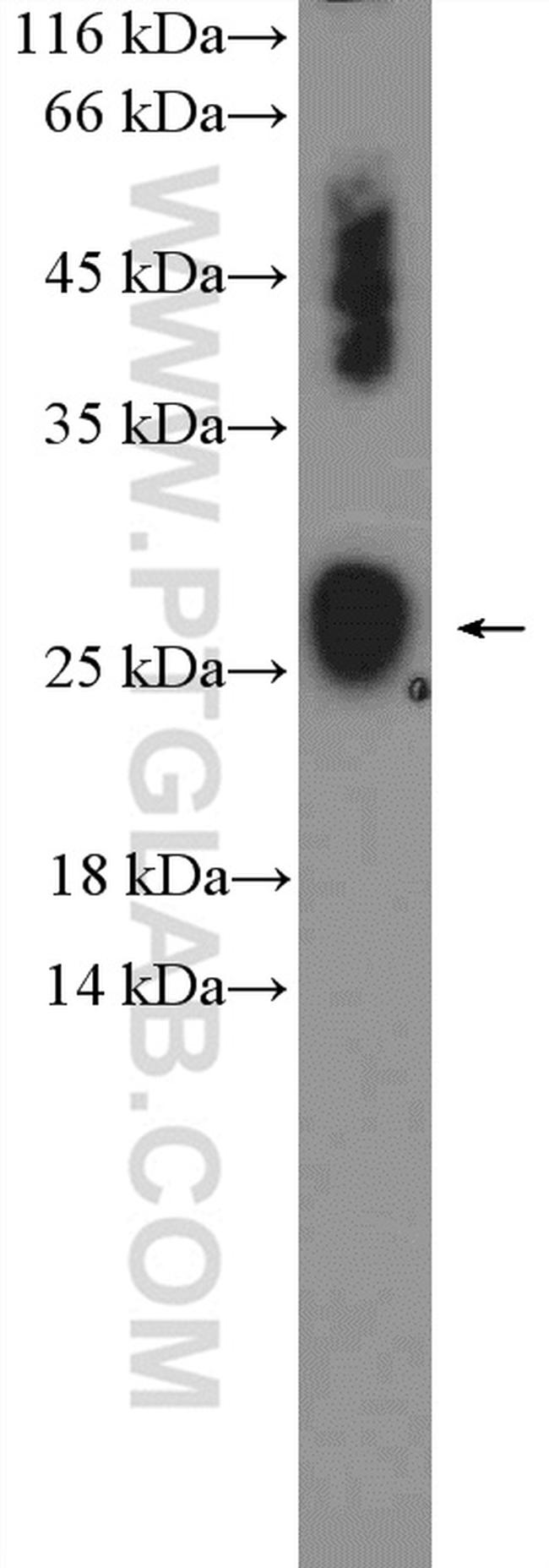 NDUFS8 Antibody in Western Blot (WB)