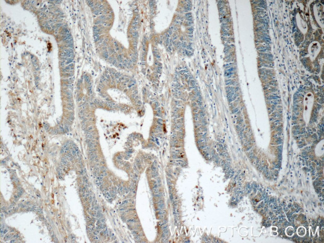 SAMD9L Antibody in Immunohistochemistry (Paraffin) (IHC (P))