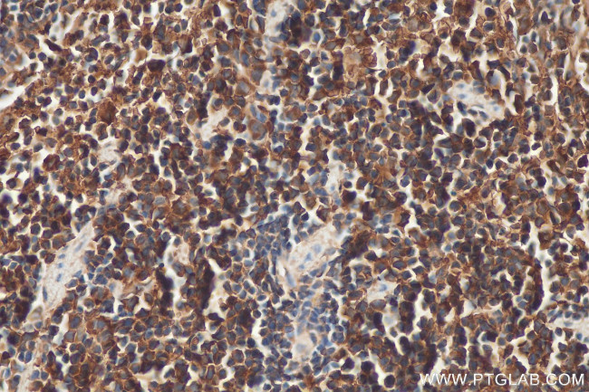 SAMD9L Antibody in Immunohistochemistry (Paraffin) (IHC (P))