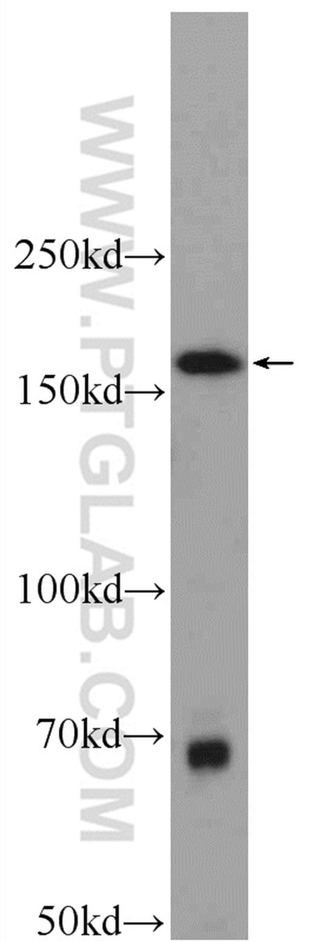 SAMD9L Antibody in Western Blot (WB)