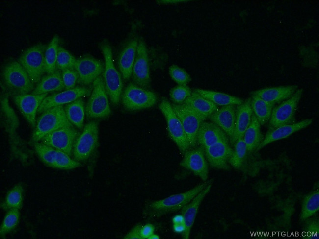 QPRT Antibody in Immunocytochemistry (ICC/IF)