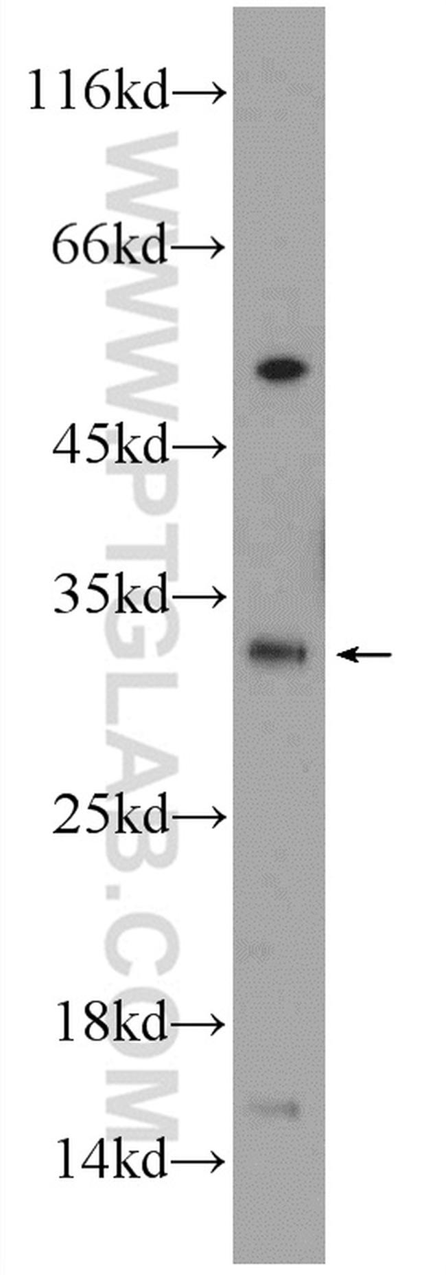 QPRT Antibody in Western Blot (WB)