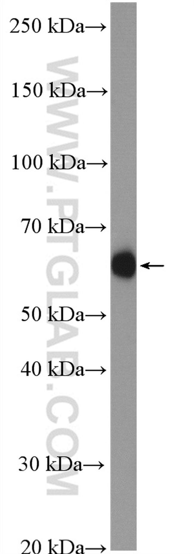 HYAL1 Antibody in Western Blot (WB)