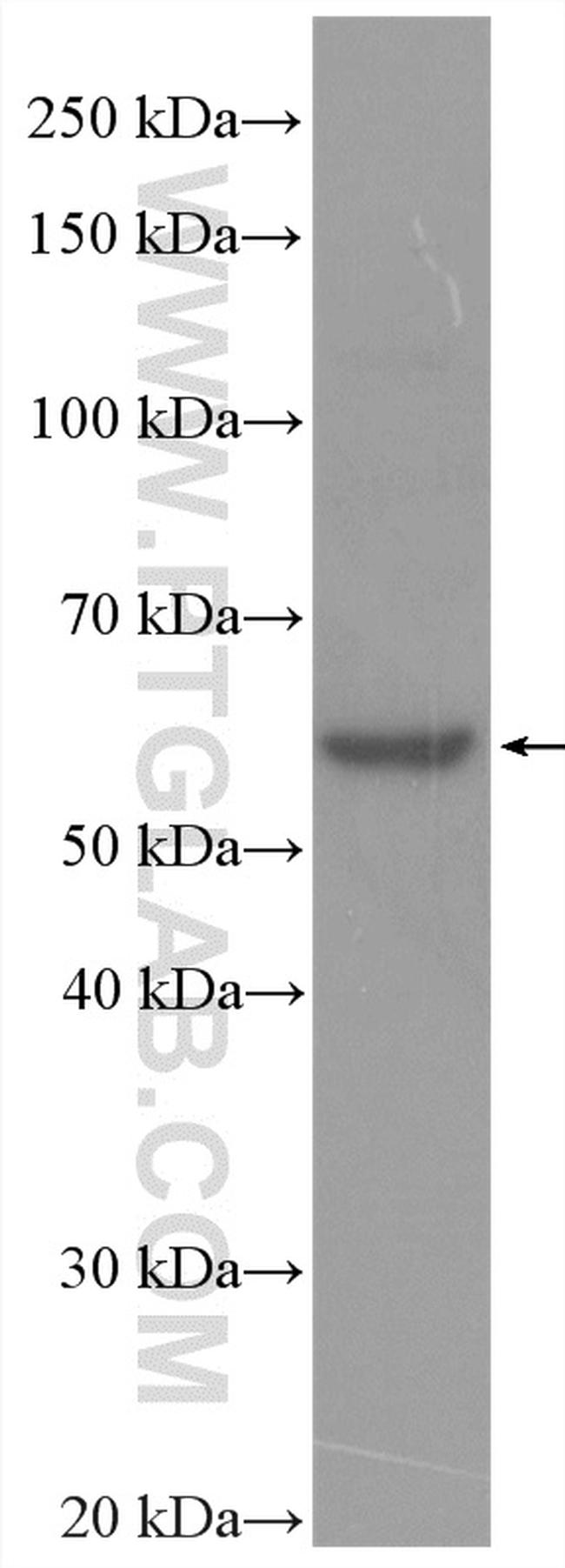 HYAL1 Antibody in Western Blot (WB)