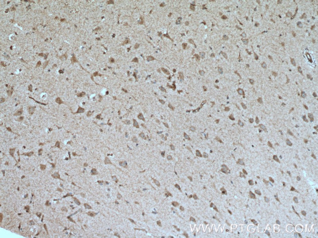 ROBO1 Antibody in Immunohistochemistry (Paraffin) (IHC (P))