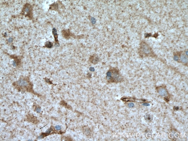 ROBO1 Antibody in Immunohistochemistry (Paraffin) (IHC (P))