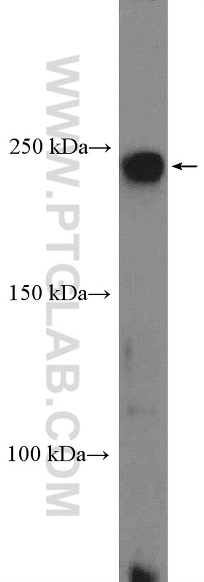 ROBO1 Antibody in Western Blot (WB)