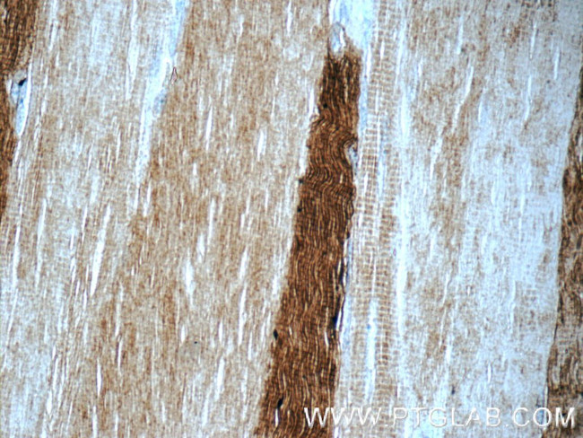 MYH1 (N-terminal) Antibody in Immunohistochemistry (Paraffin) (IHC (P))