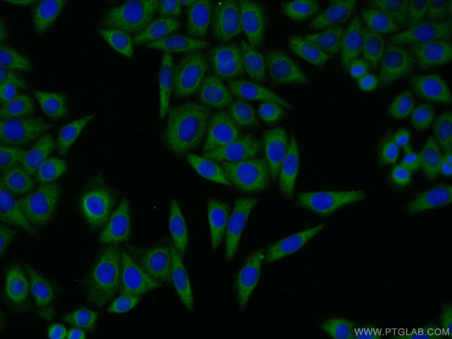 GBF1 Antibody in Immunocytochemistry (ICC/IF)