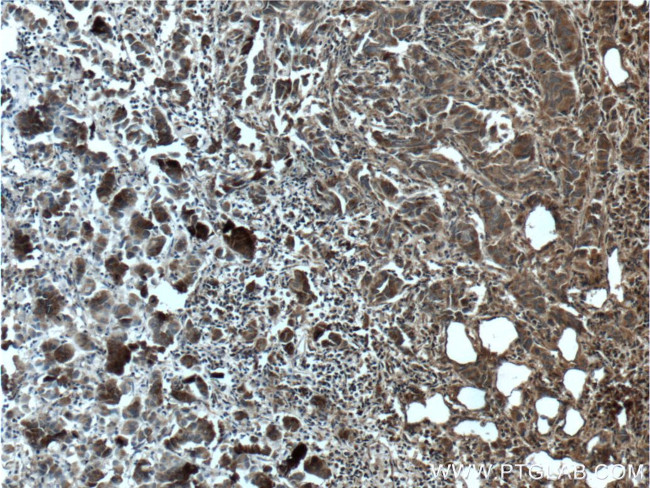 GBF1 Antibody in Immunohistochemistry (Paraffin) (IHC (P))