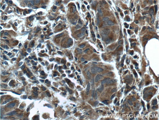 GBF1 Antibody in Immunohistochemistry (Paraffin) (IHC (P))