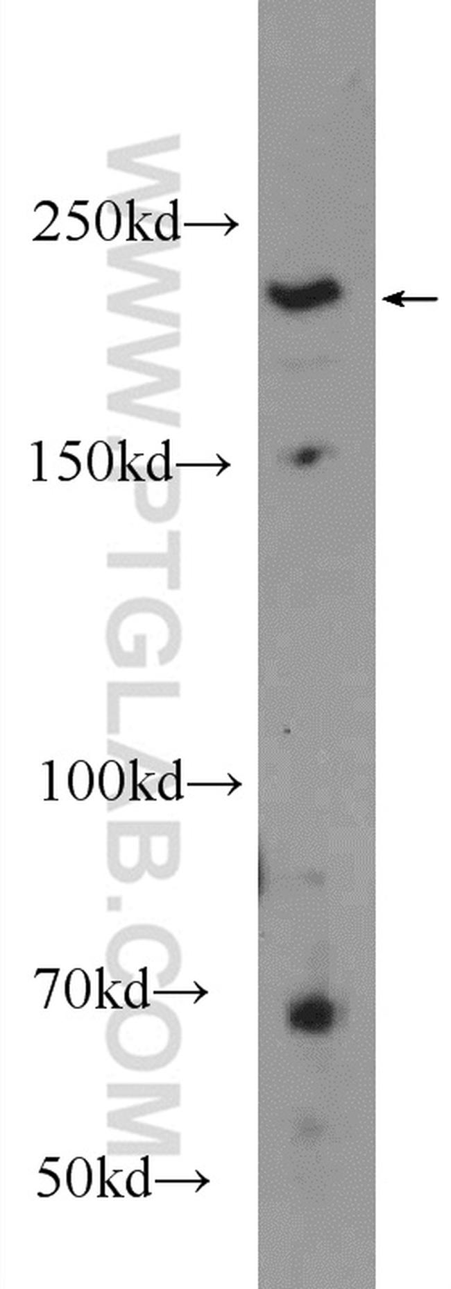 GBF1 Antibody in Western Blot (WB)