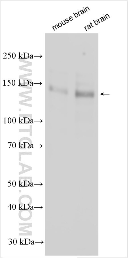 MAGI2 Antibody in Western Blot (WB)