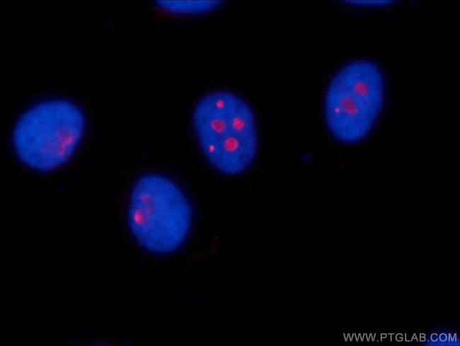 RSL24D1 Antibody in Immunocytochemistry (ICC/IF)