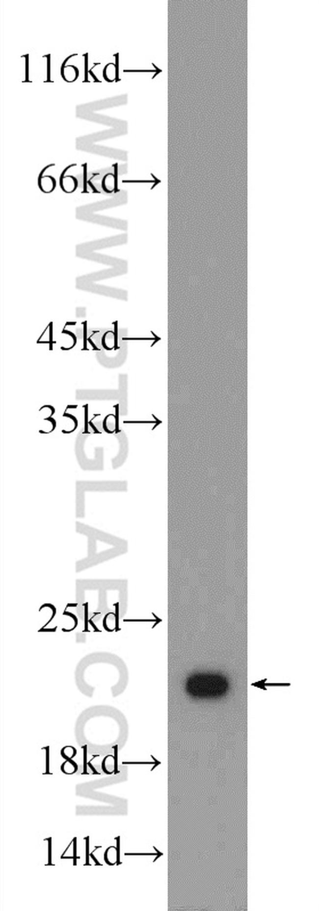 RSL24D1 Antibody in Western Blot (WB)