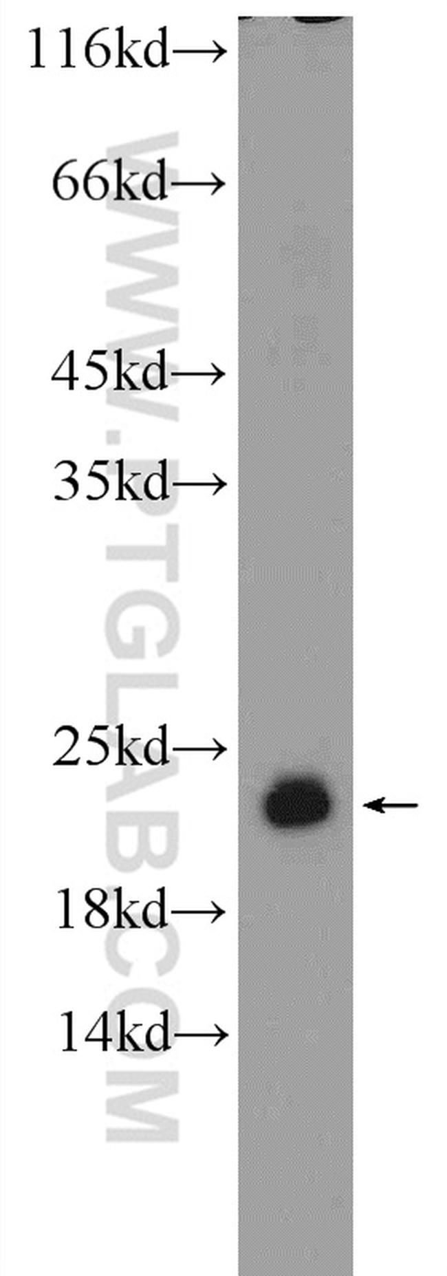 RSL24D1 Antibody in Western Blot (WB)