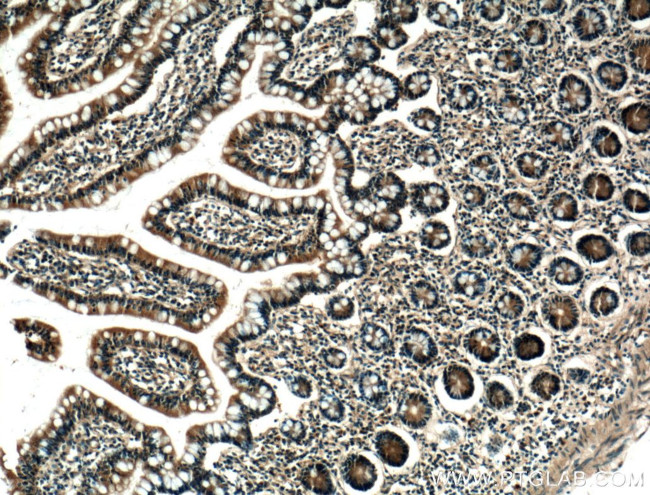 FBP2 Antibody in Immunohistochemistry (Paraffin) (IHC (P))