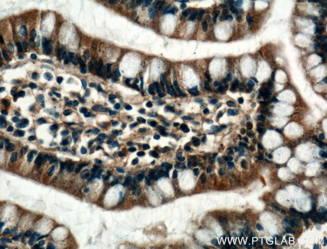 FBP2 Antibody in Immunohistochemistry (Paraffin) (IHC (P))