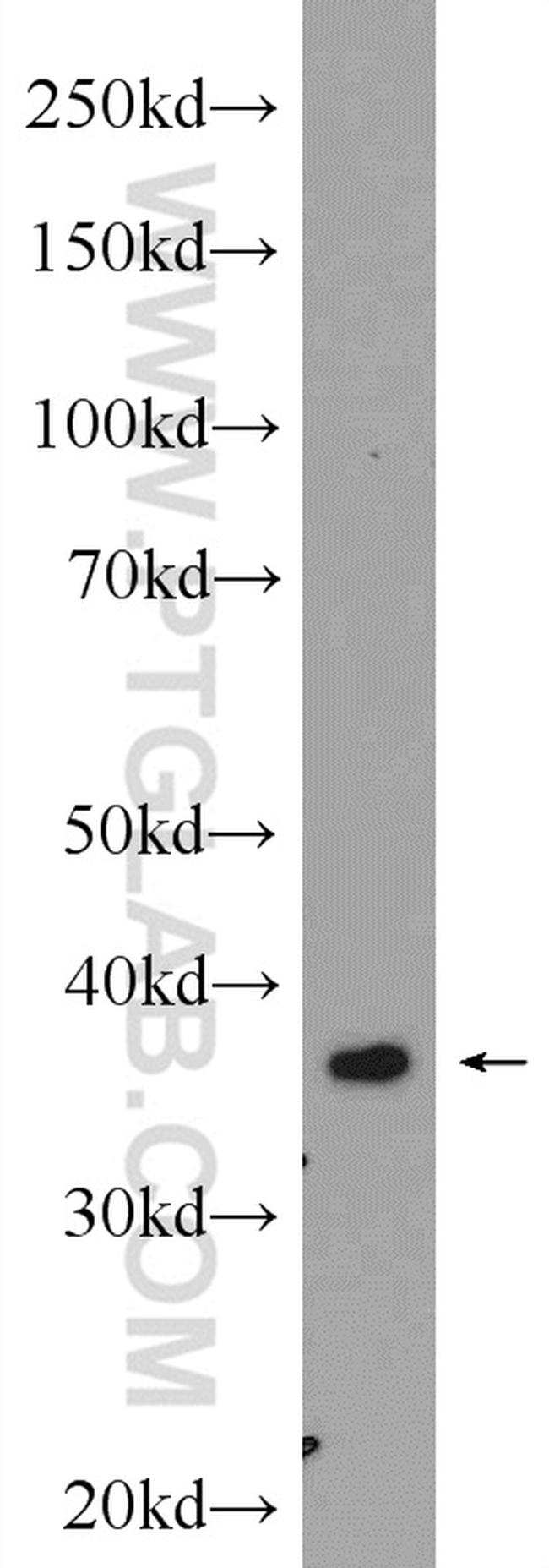 FBP2 Antibody in Western Blot (WB)