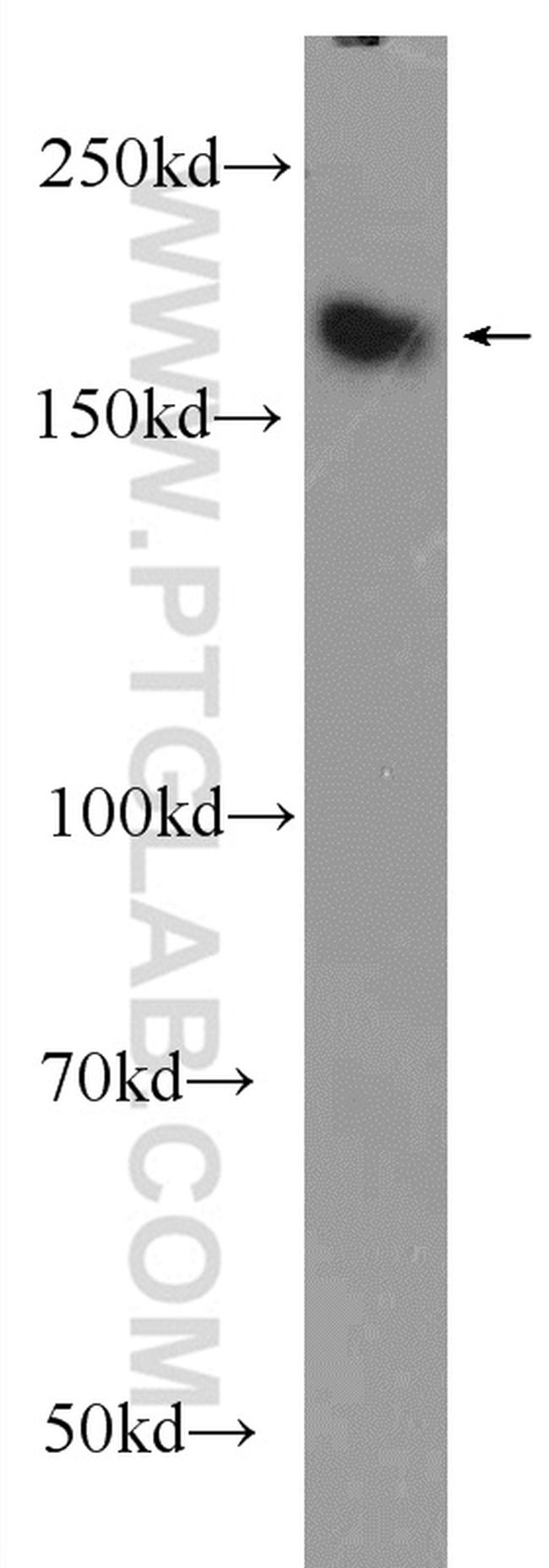 ZCCHC6 Antibody in Western Blot (WB)