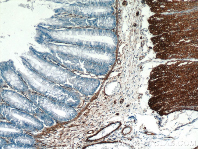 AKAP12 Antibody in Immunohistochemistry (Paraffin) (IHC (P))