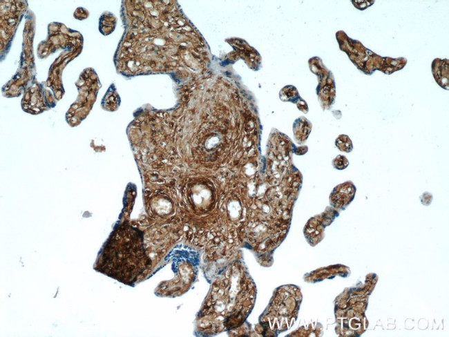 AKAP12 Antibody in Immunohistochemistry (Paraffin) (IHC (P))