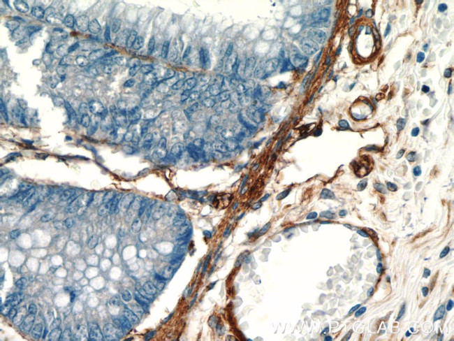 AKAP12 Antibody in Immunohistochemistry (Paraffin) (IHC (P))