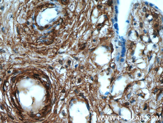 AKAP12 Antibody in Immunohistochemistry (Paraffin) (IHC (P))