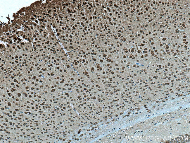 AKAP12 Antibody in Immunohistochemistry (Paraffin) (IHC (P))