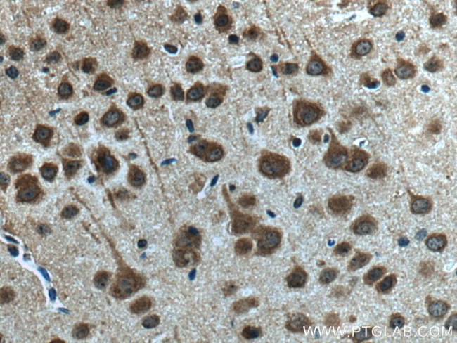 AKAP12 Antibody in Immunohistochemistry (Paraffin) (IHC (P))