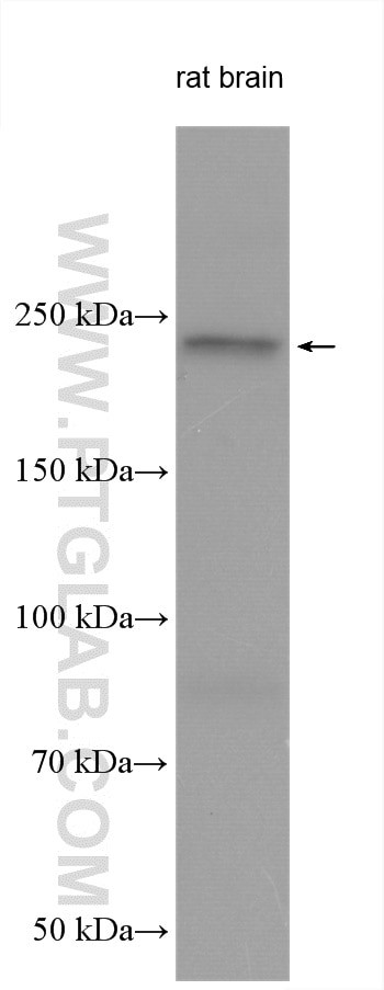 AKAP12 Antibody in Western Blot (WB)