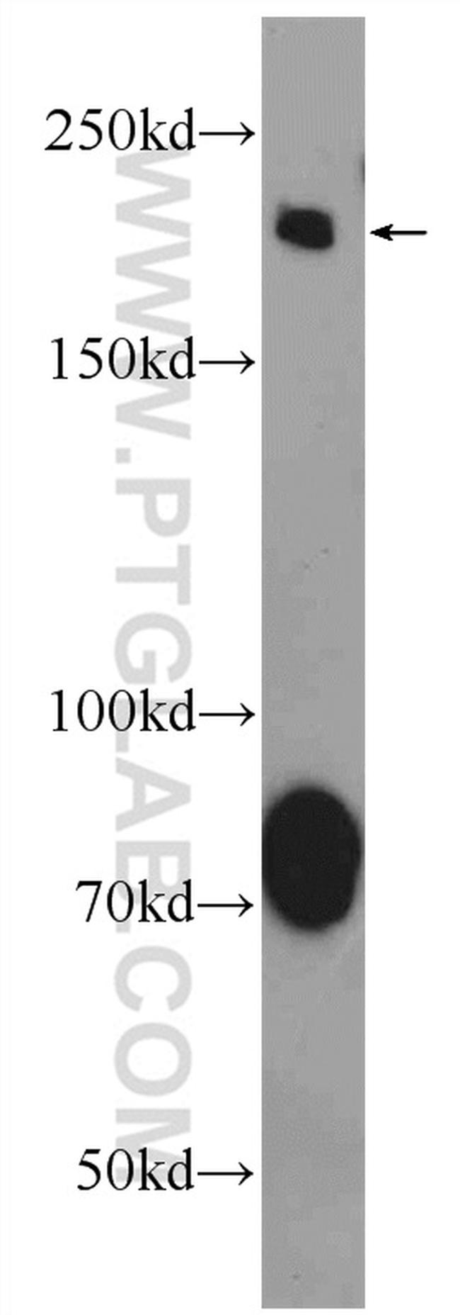 AKAP12 Antibody in Western Blot (WB)