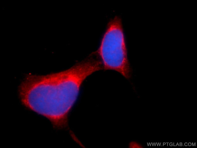 DDHD2 Antibody in Immunocytochemistry (ICC/IF)