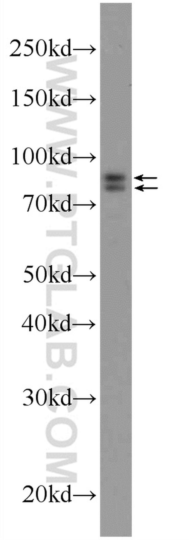 DDHD2 Antibody in Western Blot (WB)