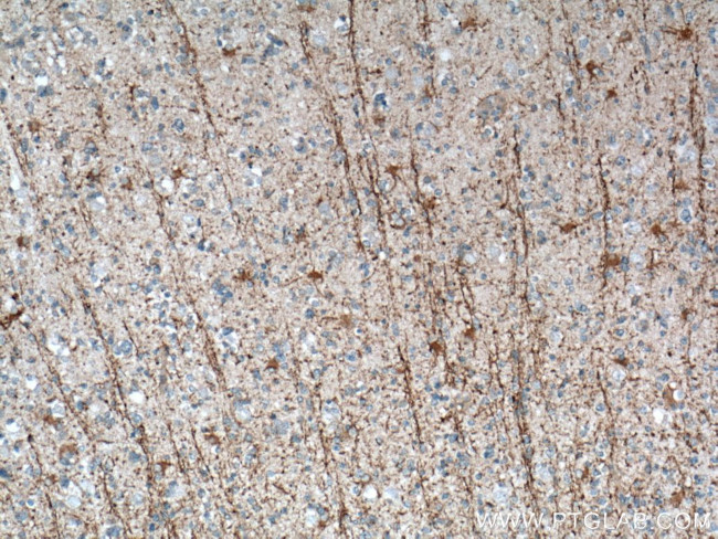 DAAM2 Antibody in Immunohistochemistry (Paraffin) (IHC (P))