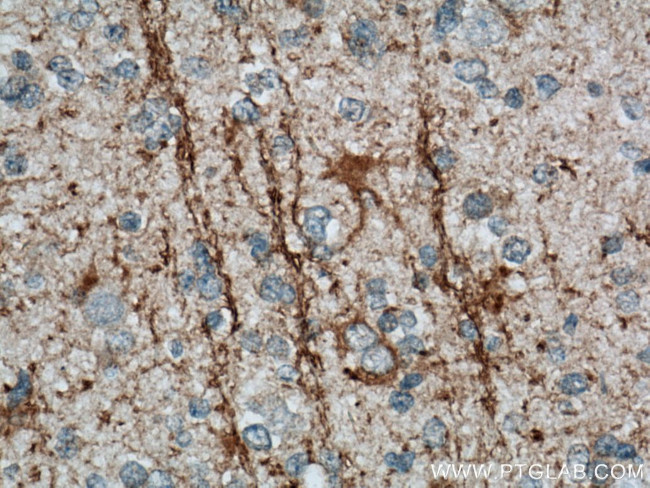 DAAM2 Antibody in Immunohistochemistry (Paraffin) (IHC (P))