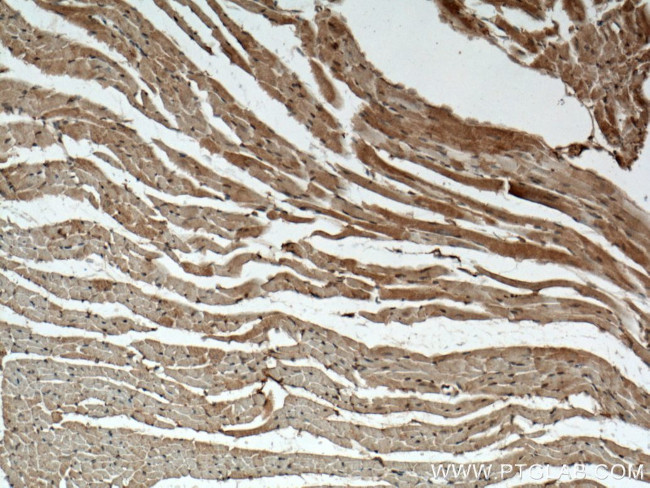 DAAM2 Antibody in Immunohistochemistry (Paraffin) (IHC (P))