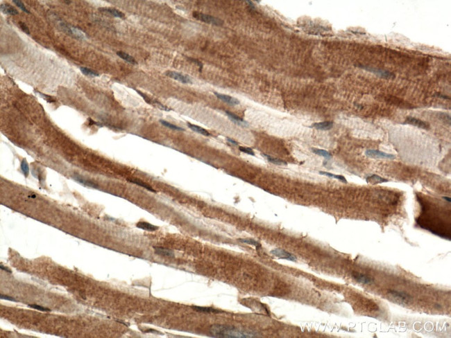 DAAM2 Antibody in Immunohistochemistry (Paraffin) (IHC (P))