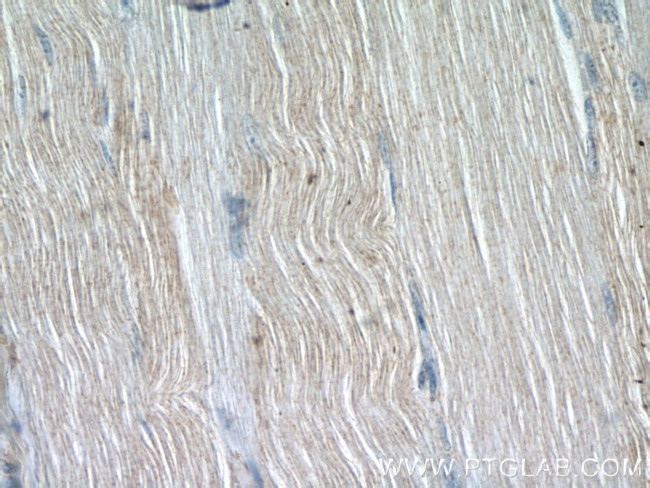 OSTN Antibody in Immunohistochemistry (Paraffin) (IHC (P))