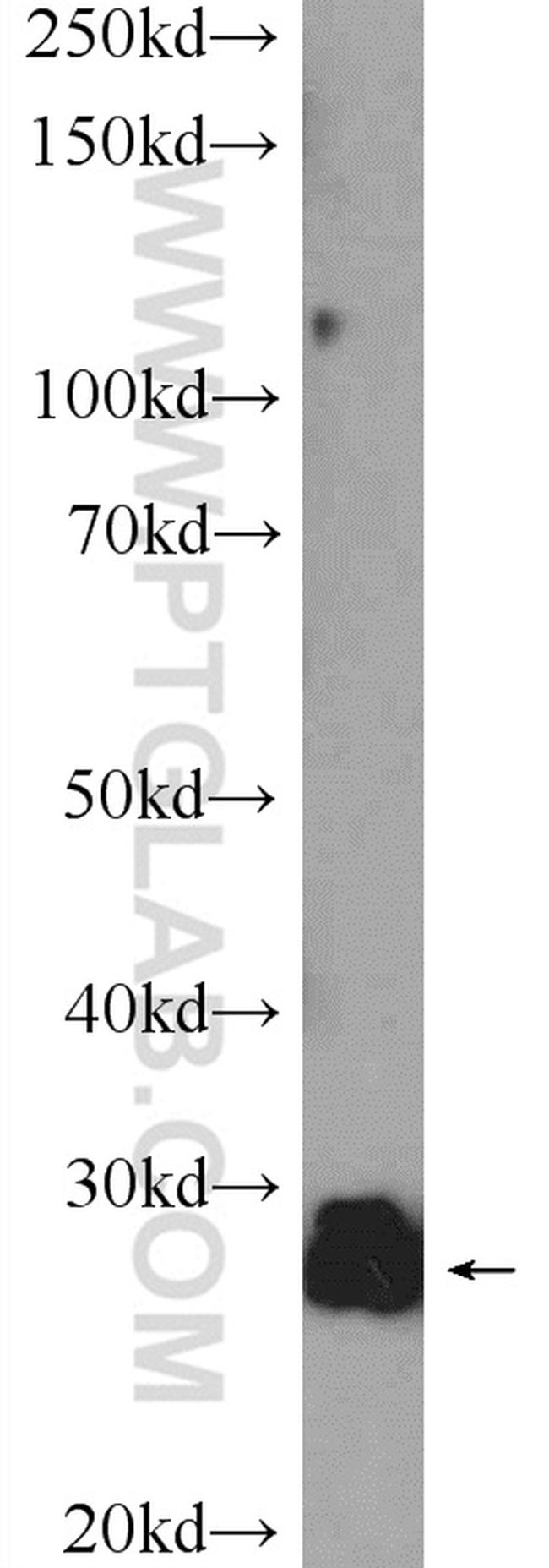 TXNDC9 Antibody in Western Blot (WB)