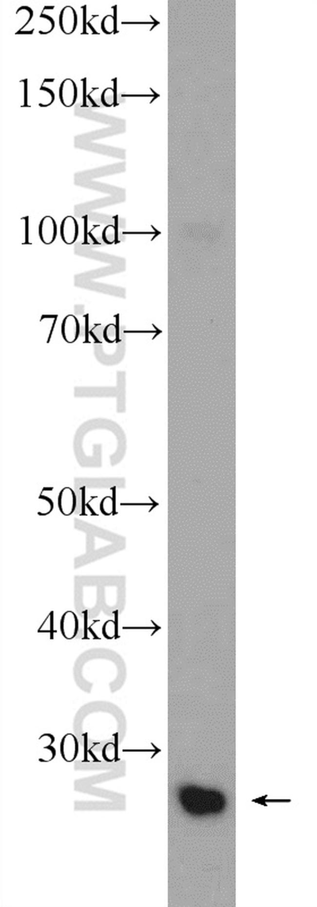 TXNDC9 Antibody in Western Blot (WB)