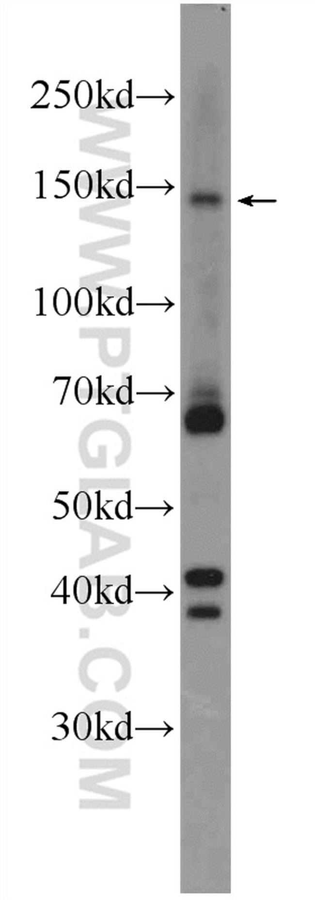 ZBTB11 Antibody in Western Blot (WB)