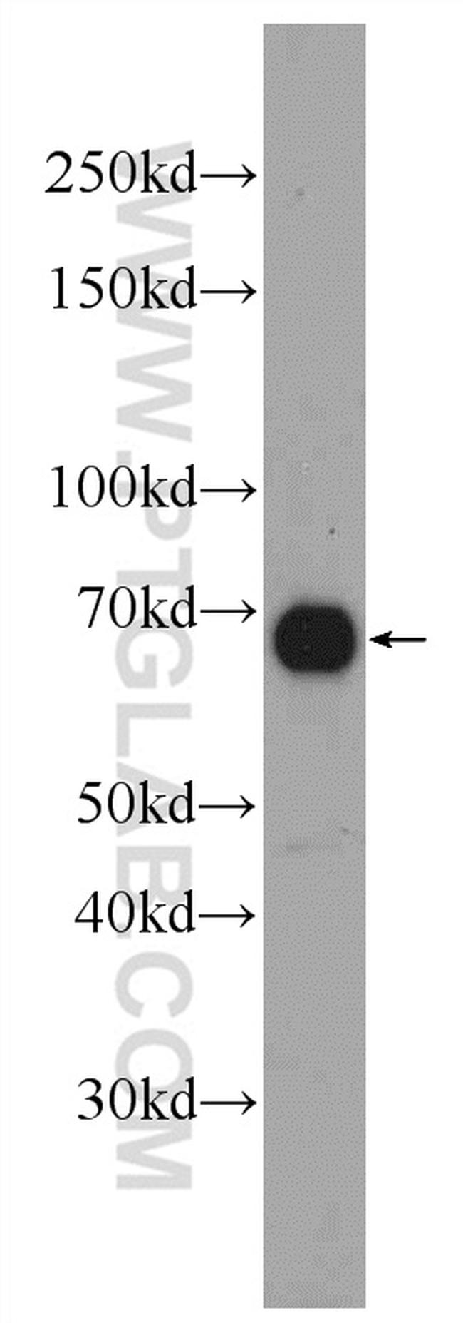 DACH2 Antibody in Western Blot (WB)