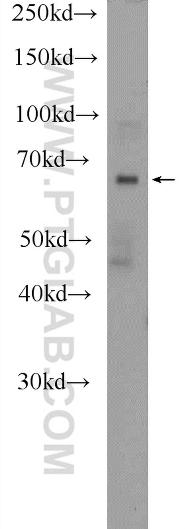 DACH2 Antibody in Western Blot (WB)