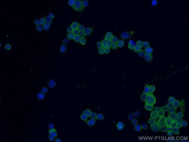 Galectin 10 Antibody in Immunocytochemistry (ICC/IF)