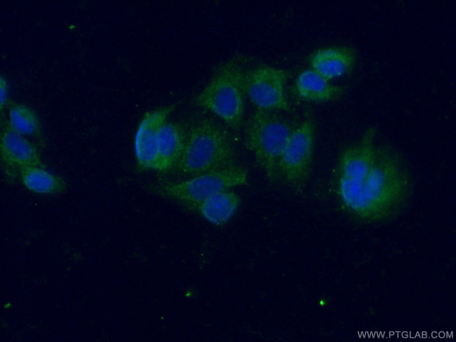 Galectin 10 Antibody in Immunocytochemistry (ICC/IF)