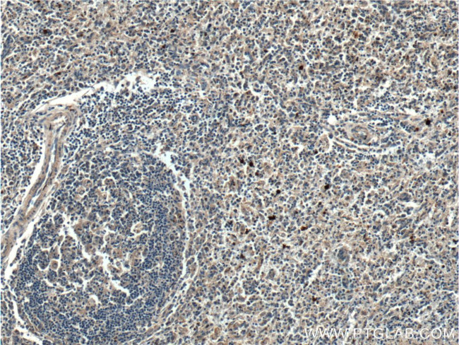 Galectin 10 Antibody in Immunohistochemistry (Paraffin) (IHC (P))